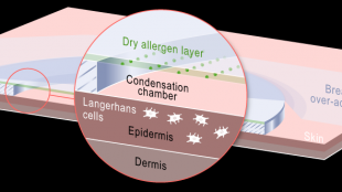 This diagram shows how the epicutaneous patch approach functions